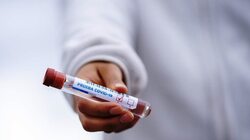Медики выявили 70 случаев коронавируса в Белгородской области за сутки
