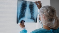 Белгородский врач Тамара Малыхина – о туберкулёзе и его профилактике 