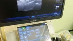 Новый аппарат УЗИ поступил в Белгородскую областную детскую клиническую больницу 